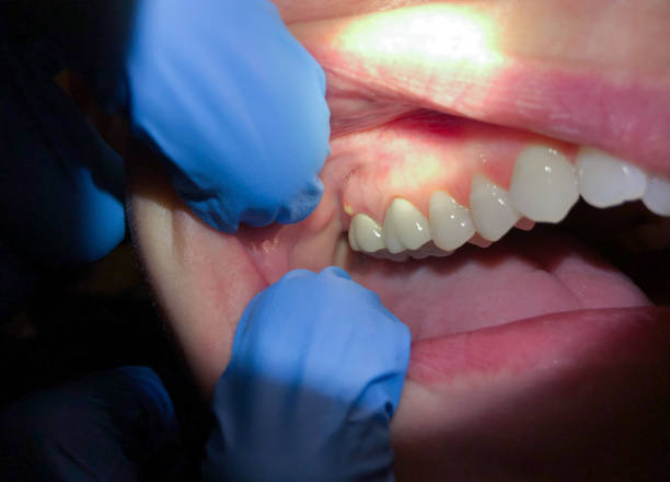 Best Orthodontic Emergency Dentist in Mked Tree, AR